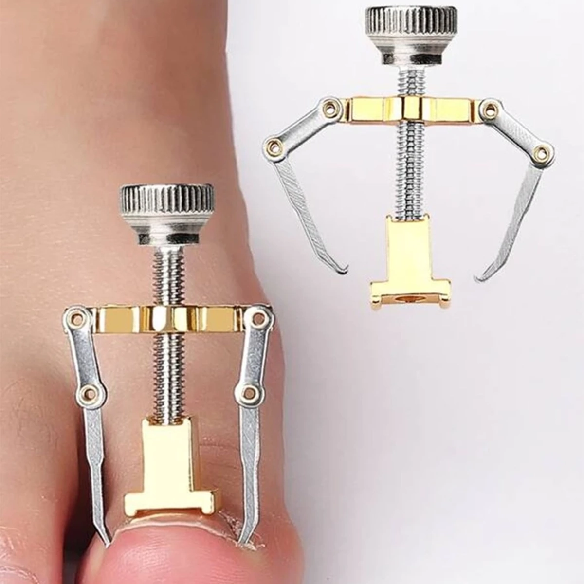 ارتودنسی ناخن