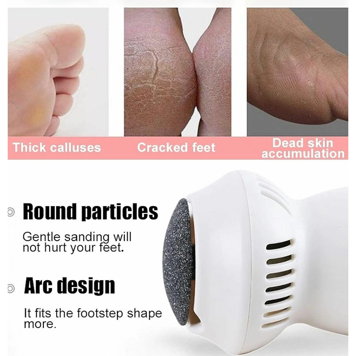 سنگ پا تخم مرغی callus remover